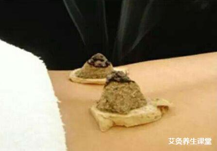冬天艾灸有什么好处?什么人适合冬季艾灸呢?