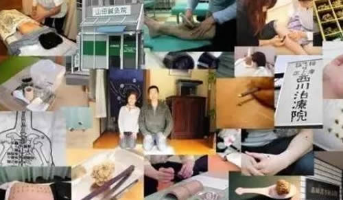 艾灸国际行情:艾灸普遍了日本!