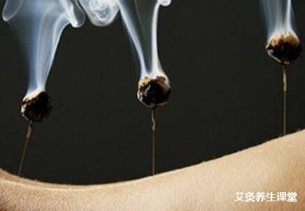 艾灸什么感觉?感觉到了通窜感算灸感吗?