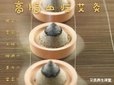 高脂血症用艾灸疗法灸这几个穴位即可