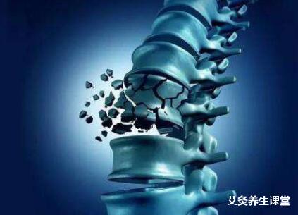 治疗骨质疏松艾灸有效果吗?