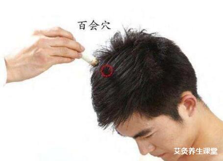 艾灸可灸头吗?脑袋可以艾灸吗?