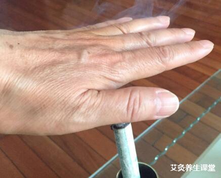 艾灸如何治好了我的腱鞘炎!艾灸案例