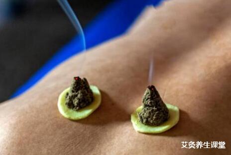 艾灸时不是越烫越好!小心烫伤自己