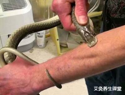 艾灸治疗毒蛇咬伤的案例介绍