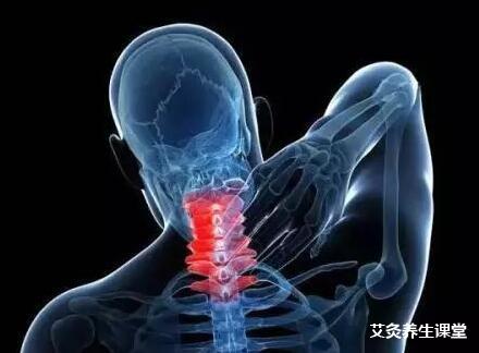 想治好颈椎病可以艾灸这六个穴位