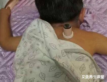 立冬儿童如何调理?艾灸提高免疫力