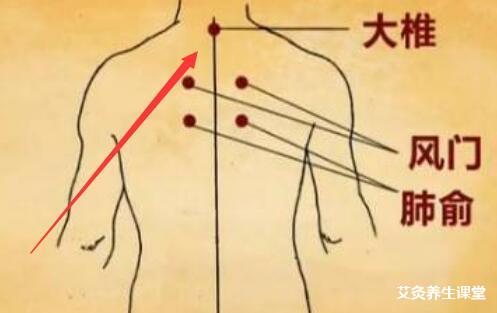 家庭艾灸大椎穴不仅补阳气还治颈椎病