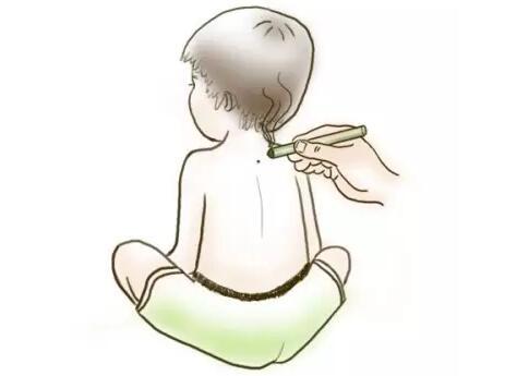 儿童艾灸有哪些好处?如何操作?