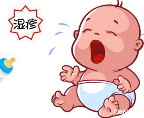 治疗湿疹可以艾灸吗?