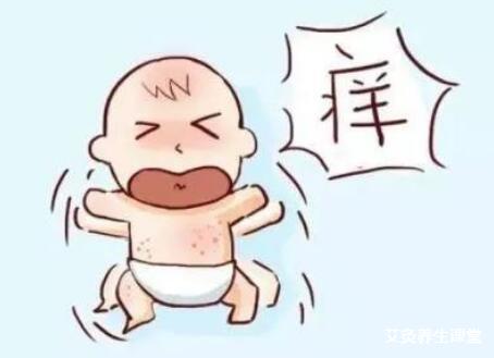 艾灸能治疗小孩子的湿疹吗?