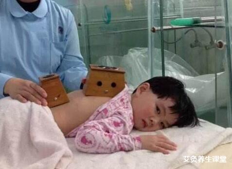 孩子艾灸后能洗澡吗?