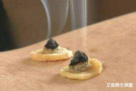 艾灸对孩子的好处和坏处?