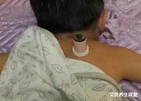 小孩子可以经常艾灸吗?