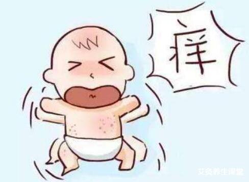 艾灸可以治孩子湿疹吗?