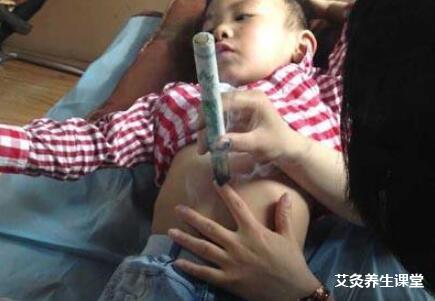 艾灸小孩子可以做吗?