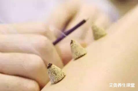 春天能不能艾灸后背?