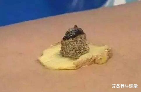 春天可以艾灸肚脐眼吗?