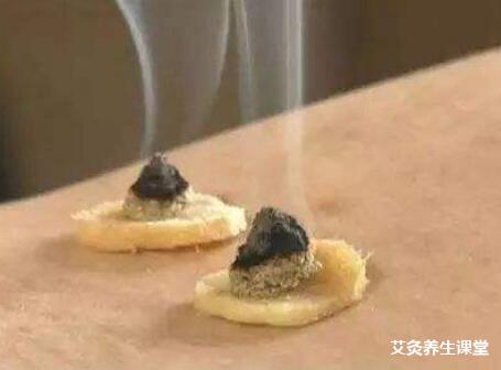 春天适合艾灸吗?春季可以艾灸哪里?