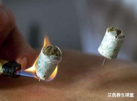 艾灸补阳祛湿要灸哪些穴位?湿气分内湿与外湿