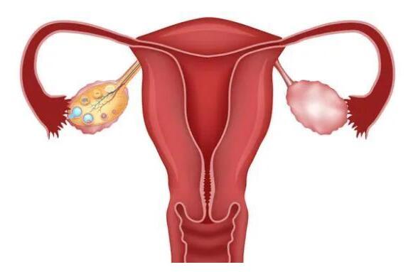 女人的下半身，决定女人下半生!保养卵巢、子宫，艾灸有良效